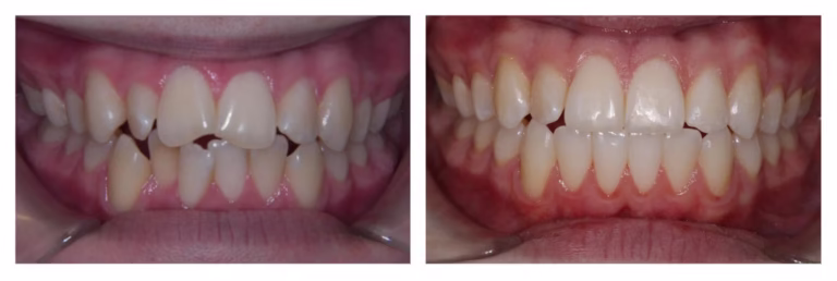 Ortho-16-1536x515