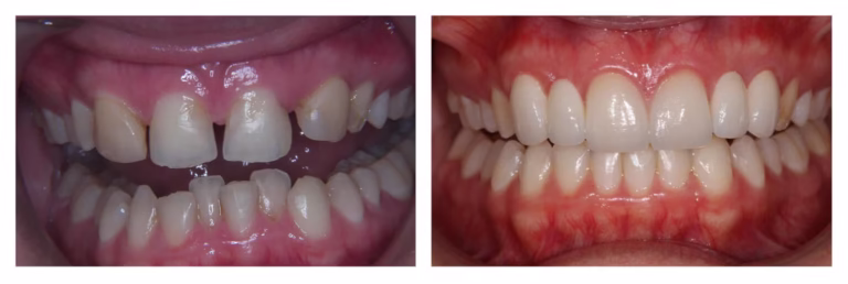 Ortho-17-1536x515