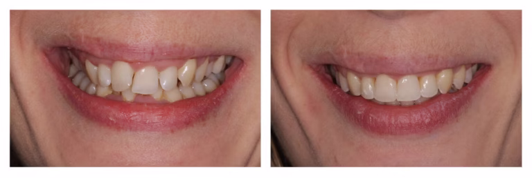 Ortho-18-1536x515
